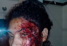 CAICÓ: Mulher é agredida a tijoladas pelo companheiro após noite de bebedeira