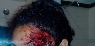 CAICÓ: Mulher é agredida a tijoladas pelo companheiro após noite de bebedeira