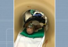 Imagens mostram flecha atravessada em homem que teve pulmões perfurados após ser atingido em Salvador Imagens mostram homem com flexa atravessada na Bahia — Foto: Reprodução/TV Bahia