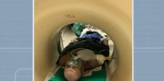 Imagens mostram flecha atravessada em homem que teve pulmões perfurados após ser atingido em Salvador Imagens mostram homem com flexa atravessada na Bahia — Foto: Reprodução/TV Bahia