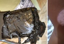 Celular que carregava ao lado da cama explode e queima estudante de enfermagem no interior de SP Mulher teve queimaduras no braço e no cableo após o celular explodir enquanto carregava em Salto — Foto: Arquivo pessoal