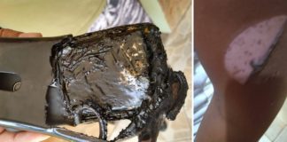 Celular que carregava ao lado da cama explode e queima estudante de enfermagem no interior de SP Mulher teve queimaduras no braço e no cableo após o celular explodir enquanto carregava em Salto — Foto: Arquivo pessoal