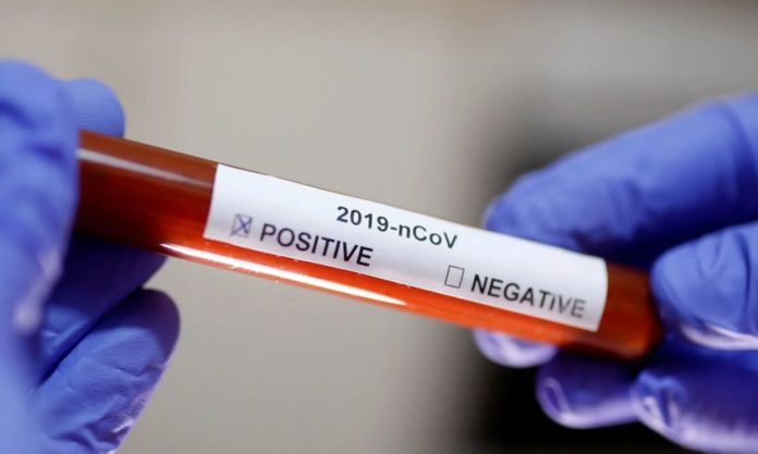Ministério informou também que vai alterar o fluxo de notificação dos casos suspeitos do novo coronavírus a partir da próxima segunda-feira (2) | Foto: Reuters