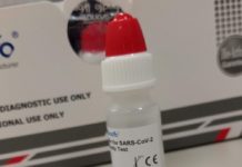 Testes rápidos para detecção do coronavírus começam a ser aplicados nesta semana no RN, diz Sesap Testes rápidos serão aplicados em profissionais de saúde, e parte será enviada para pesquisa, na UFPel — Foto: Divulgação/SES