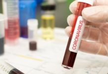 Mortes por Covid-19 no RN sobem para 87; confirmações da doença somam 1.919