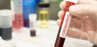 Número de mortes no RN por Covid-19 sobe para 54 e casos confirmados já somam 1.086