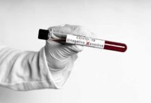 Técnico de enfermagem morre infectado pelo coronavírus, diz Secretaria de Saúde; número de mortos chega a três no RN