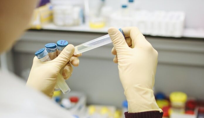 Empresa está realizando testes clínicos de quatro opções de vacina para a doença (Foto: Polina Tankilevitch/Pexels)