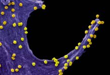 Primeiras imagens do Sars-CoV-2 em ação revelam mecanismos usados para se espalhar pelo corpo Imagem ampliada 84 mil vezes mostra o vírus Sars-Cov-2 (em amarelo), causador da Covid-19, atacando uma célula epitelial Foto: UFRJ / Divulgação