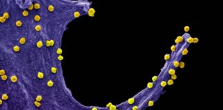 Primeiras imagens do Sars-CoV-2 em ação revelam mecanismos usados para se espalhar pelo corpo Imagem ampliada 84 mil vezes mostra o vírus Sars-Cov-2 (em amarelo), causador da Covid-19, atacando uma célula epitelial Foto: UFRJ / Divulgação