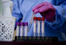 Natal tem 5.555 pacientes curados da Covid-19