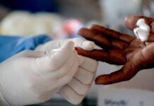 RN tem 104.855 casos confirmados de Covid-19 e 2.821 mortes pela doença