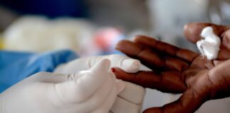 RN tem 104.855 casos confirmados de Covid-19 e 2.821 mortes pela doença