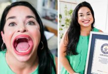 Americana bate recorde com a maior boca do mundo;