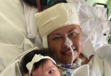 Paciente com ECMO que aguarda transplante de pulmão após complicações da Covid é transferida de Natal para SP