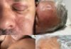 Hematomas Chocantes Revelam Agressões ao Prefeito Julio Cesar